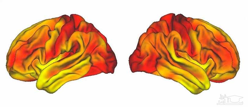 نیمکره چپ و راست مغز