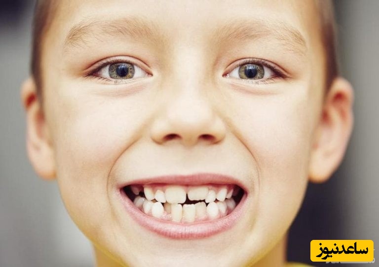 دستگاه فانکشنال ارتودنسی بر چند نوع است؟