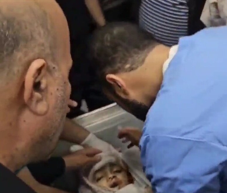 (ویدئو) لحظه روبرو شدن پزشک فلسطینی با جنازه فرزندش در بیمارستان