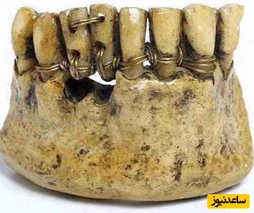 حقایق تاریخی عجیب و جالبی که در کتاب‌های تاریخ نخوانده‌اید+عکس