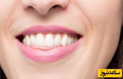 ناهنجاری اپن بایت چیست؟