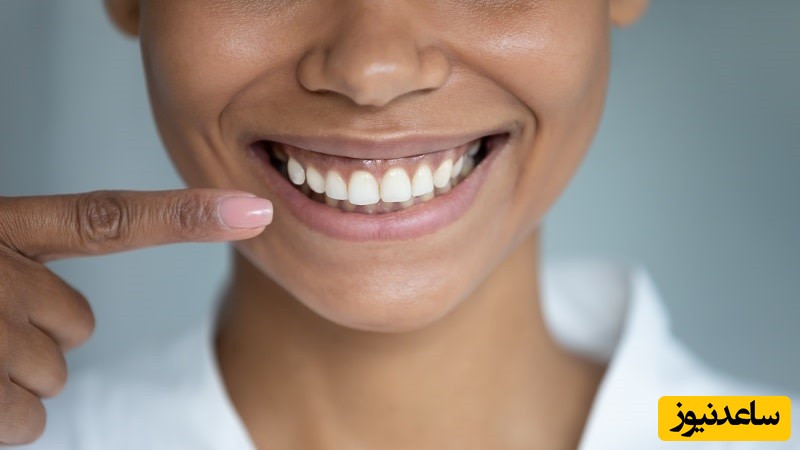 علت بروز لبخند لثه ای در افراد مختلف چیست؟