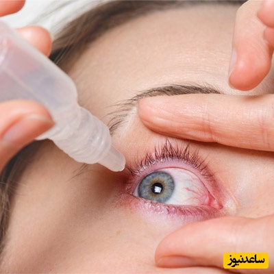 نکات مهم درباره مصرف ناتامایسین در بارداری و شیردهی