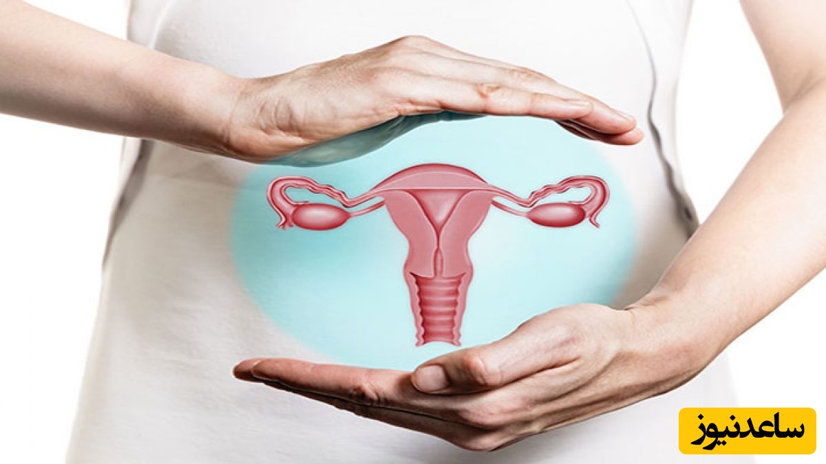 خانمها تا آخر بخوانید/ دلایل و علائم پولیپ رحم در زنان