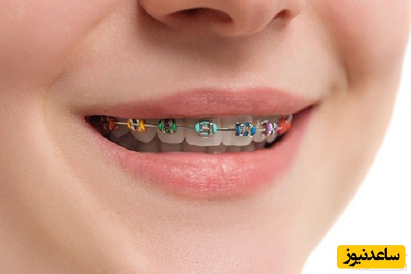 ارتودنسی چه تاثیری بر اعتماد بنفس افراد می گذارد ؟