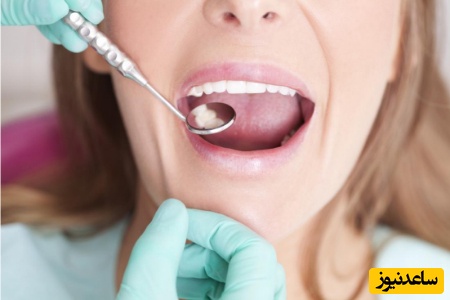 مراقبت از دندان ها و لثه ها در فصل زمستان