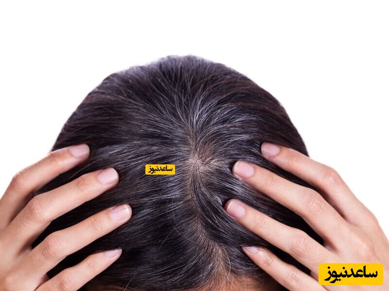 پوستر پوست سر حساس