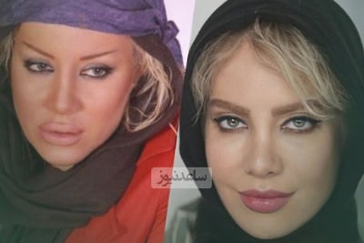 شراره رخام: تزریق ژل لب بازیگری منو نابود کرد!؛ الان به سمت نچرال بودن گرایش دارم و...+ویدیو