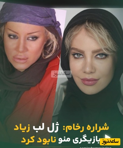 شراره رخام: تزریق ژل لب بازیگری منو نابود کرد!؛ الان به سمت نچرال بودن گرایش دارم و...+ویدیو