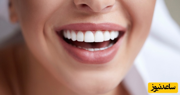 چه مواردی در طرح لبخند اهمیت دارد؟