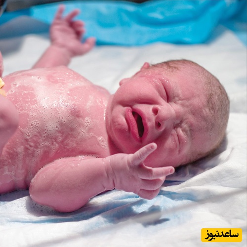 همه چیز درباره دیستوشـی شـانه نوزاد