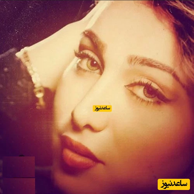 پوستر قبل عمل بهنوش بختیاری