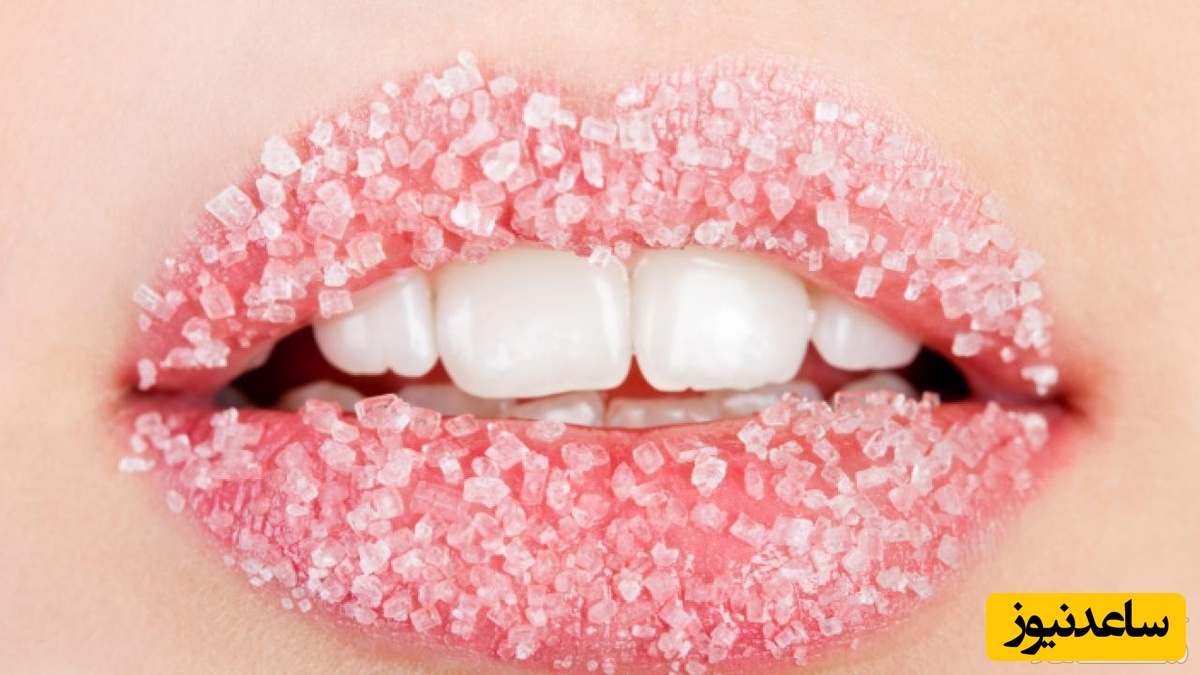 درمان کولیت لب در طب سنتی