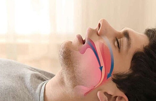 4 راهکار طلایی برای خداحافظی همیشگی با "خروپف" / اگه شوهرت با خروپف کردن نمی‌ذاره بخوابی، این ویدیو رو حتما نگاه کن!