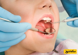 چطور از پانسمان موقت دندان مراقبت کنم؟