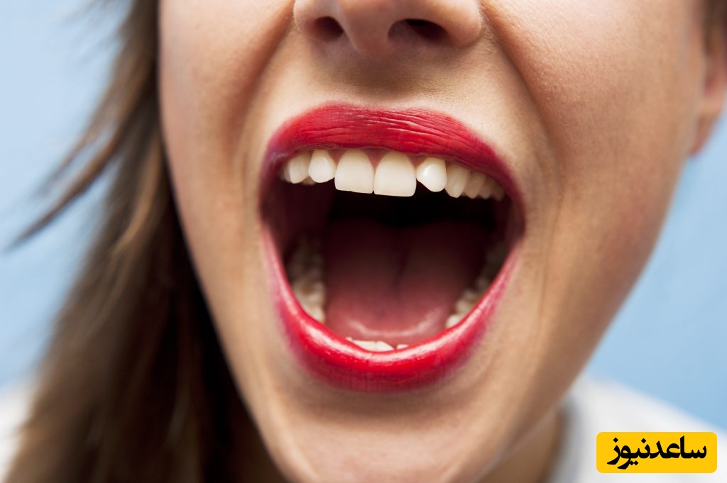 درمان سنگ لوزه به روش خانگی چگونه امکان پذیر است ؟