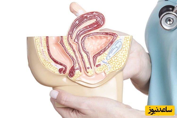 از درد کمر تا بی‌اختیاری ادرار؛ علائم کمتر شناخته‌شده رحم وارونه