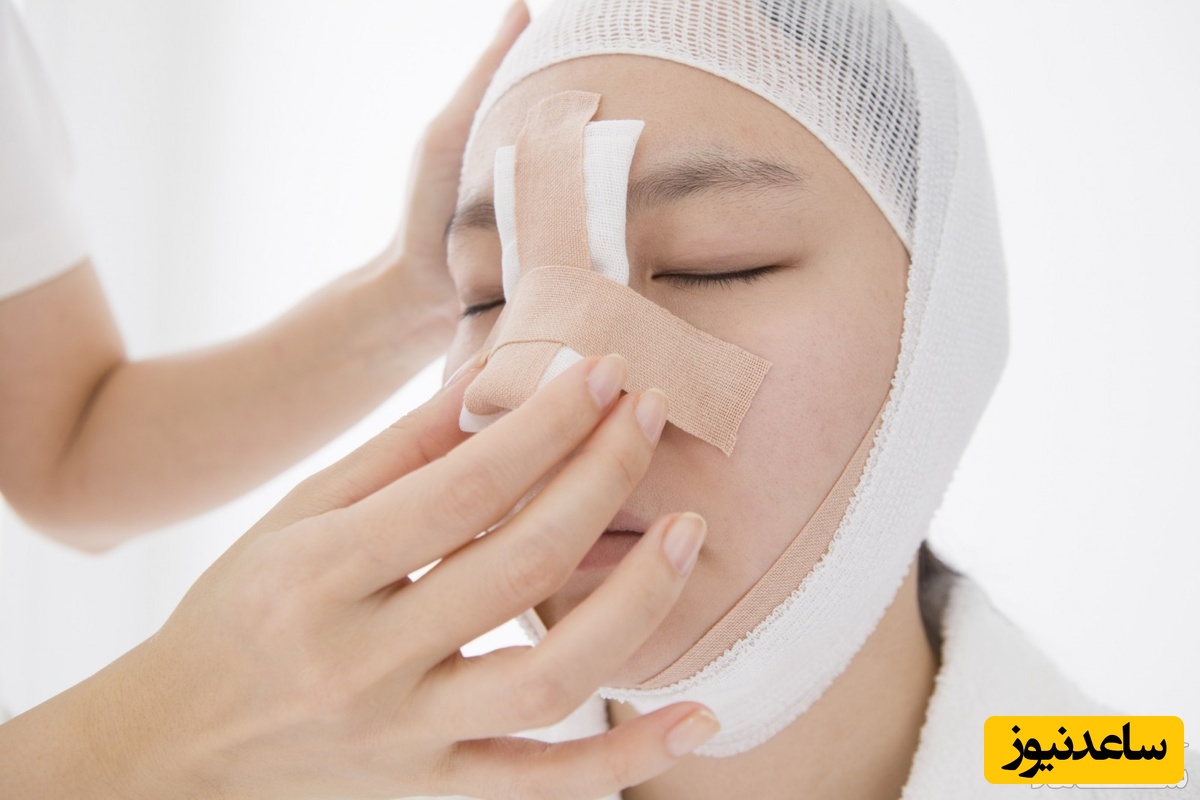 شکستگی بینی در کودکان