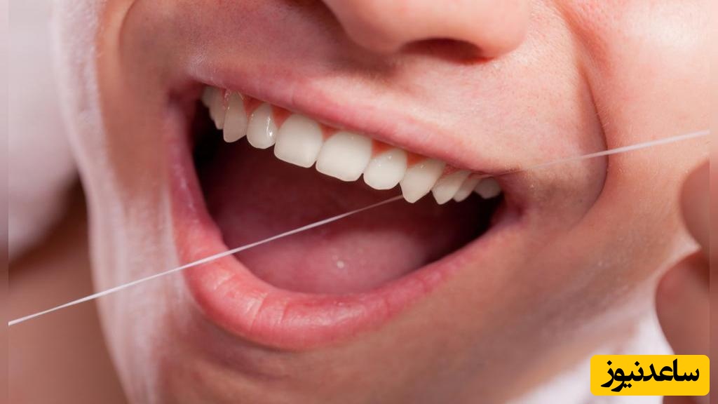گاهی نخ دندان هم مشکل ساز می شود !