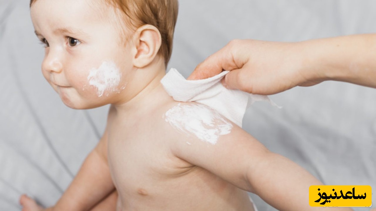 زدن لوسیون به بدن کودک