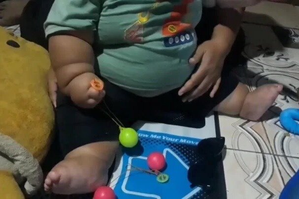 چاق ترین پسر 16 ماهه ای که مجبور است لباس های پدرش را بپوشد
