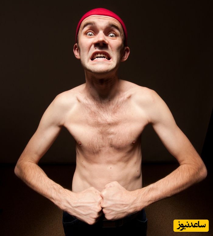 دیدن آدم لاغر در خواب چه تعبیری دارد؟ / تعبیر خواب آدم لاغر