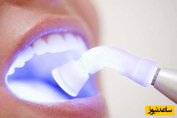 لیزر دندان و نقش آن در دندان پزشکی