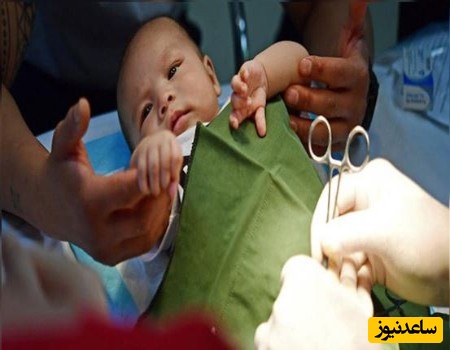 ختنه کردن نوزاد