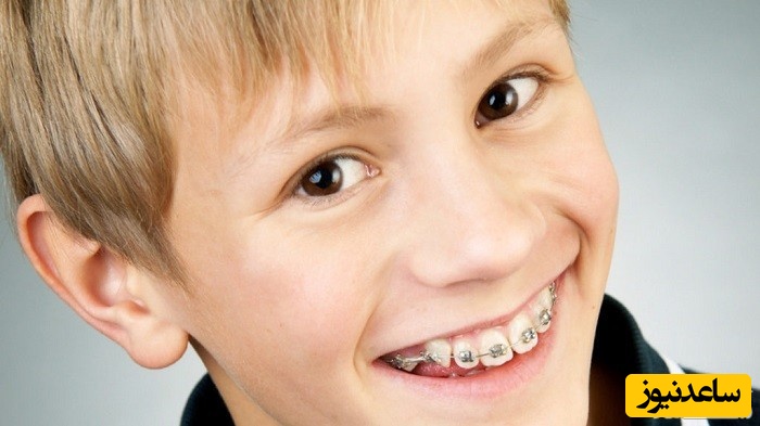 سن شروع مسواک زدن کودکان