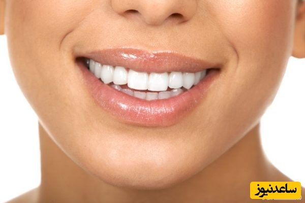 علائم پوسیدگی دندان چیست؟