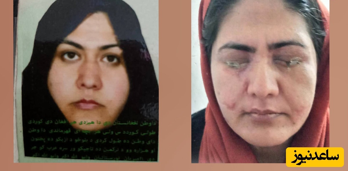 صحبت‌های دلخراش زنی که به جرم کار کردن برادرش در چشمان خواهر اسید ریخت / دست و پامو بست اسید ریخت تو قطره بعد....بهم میگه تو باید کور میشدی + ویدئو