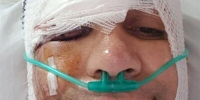 نگاهی به بازیگران و فوتبالیست‌هایی که از تصادف جان سالم به در بردند؛ از هستی مهدوی‌فر  و زهره فکورصبور تا سردار آزمون و علی دایی+ عکس