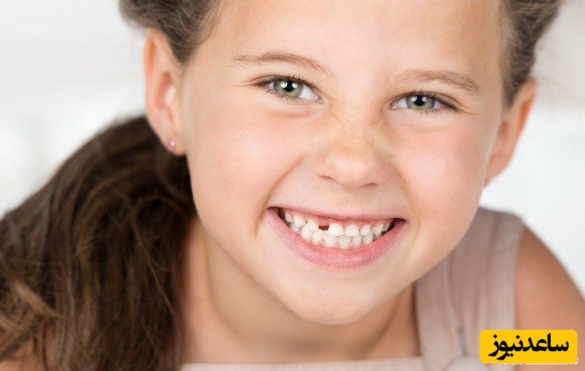 قطره آهن کودکان و تاثیر آن بر دندان