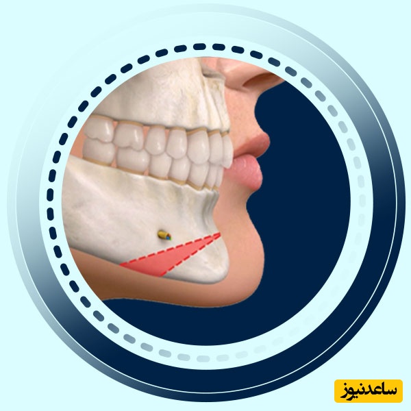 سوالات متداول جراحی فک و صورت