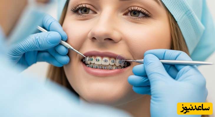 غذاهای مفید و مضر هنگام ارتودنسی چیست؟