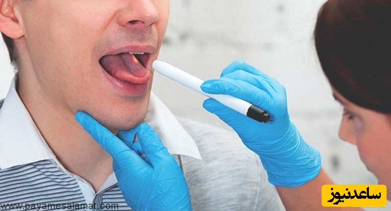 لکوپلاکی، علل و راه های جلوگیری از آن