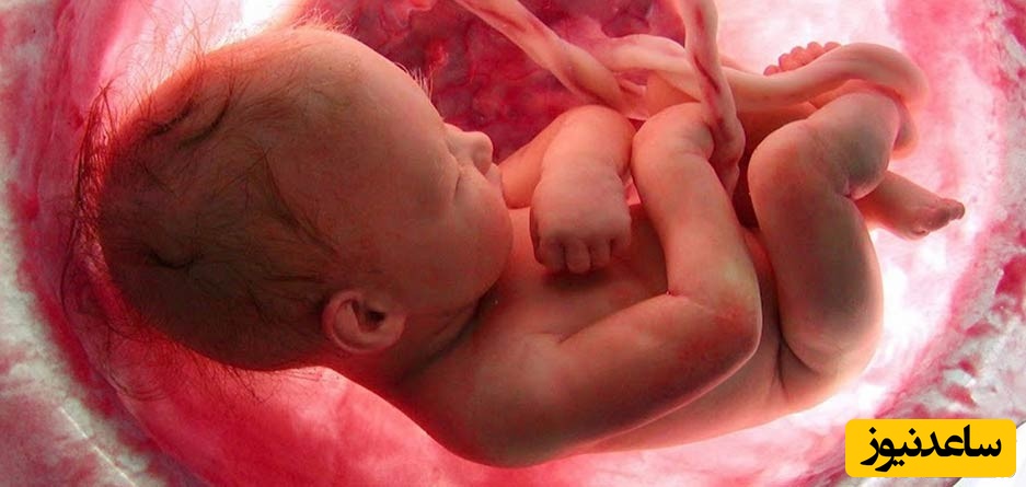 روش هایی برای چرخاندن سر جنین در شکم مادر