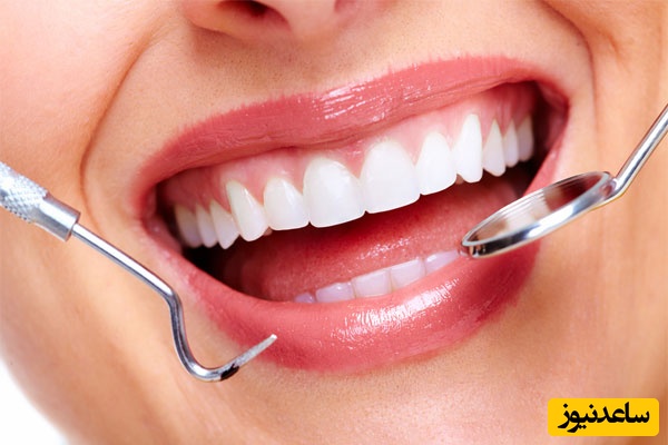 انواع بیماری‌های لثه چیست؟