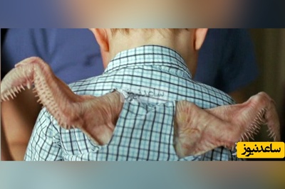 (فیلم) تولد نوزادی با دو بال واقعی / پرواز جلوی چشمان مادرش 😲