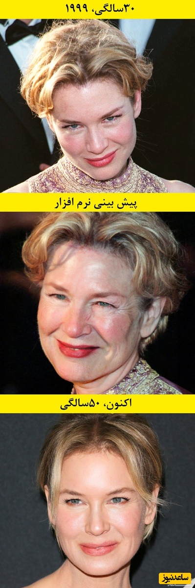رنی زلوگر