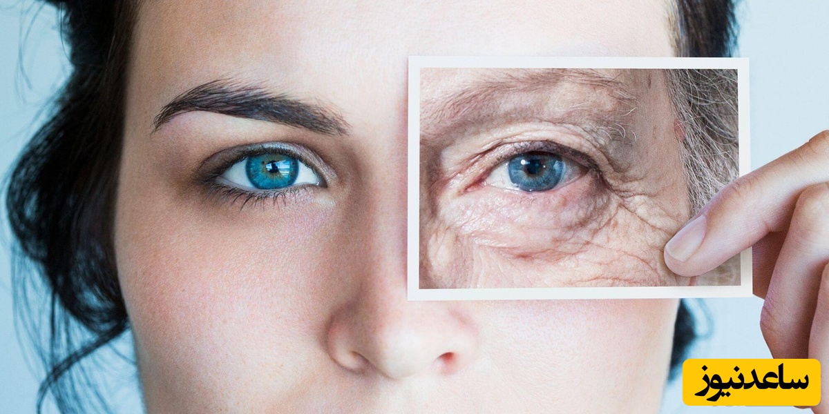 همه چیز درباره تزریق چربی زیر چشم برای زیبا تر شدن چشم ها