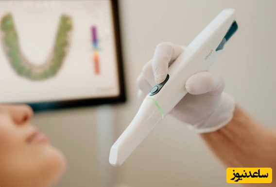 اسکنر داخل دهانی