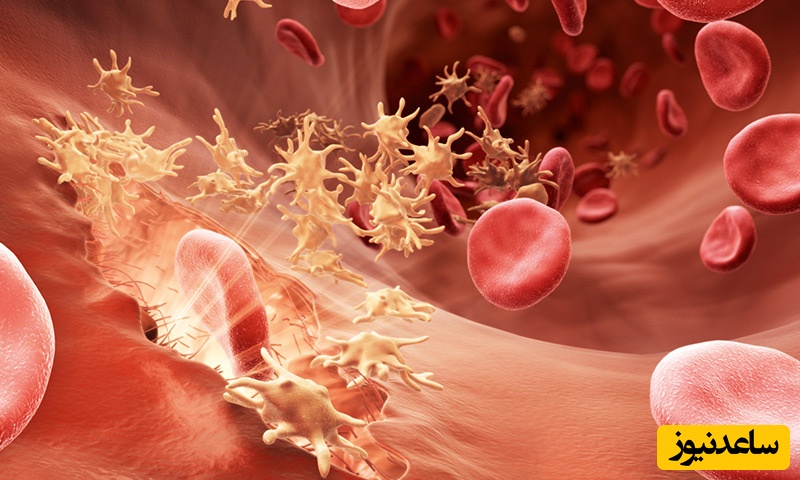 همه چیز درباره افت پلاکت خون؛ از علائم تا جدیدترین روش‌های درمان