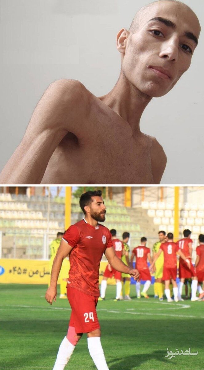 تصویری از بازیکن جوان فوتبال قبل و بعد سرطان