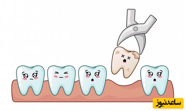 علت بوي بد دهان بعد از كشيدن دندان و چند ترفند برای درمان آن