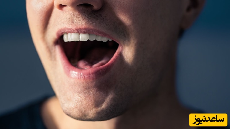 علت تلخی دهان و روش‌های درمانی