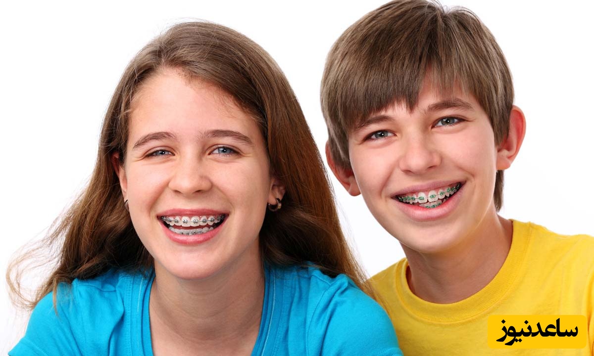 ارتودنسی در کودکان چه ویژگی هایی دارد؟