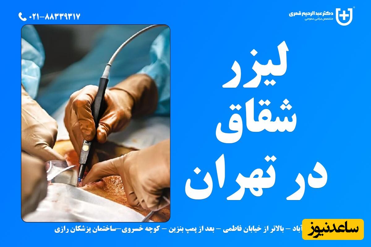 درمان شقاق یا فیشر مقعد با لیزر در تهران