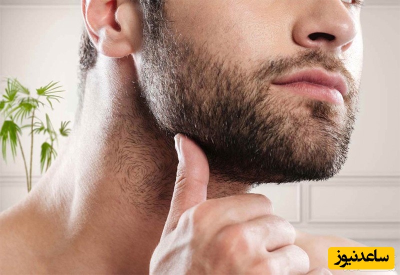 همه چیز در مورد عوارض کاشت ریش که باید بدانید