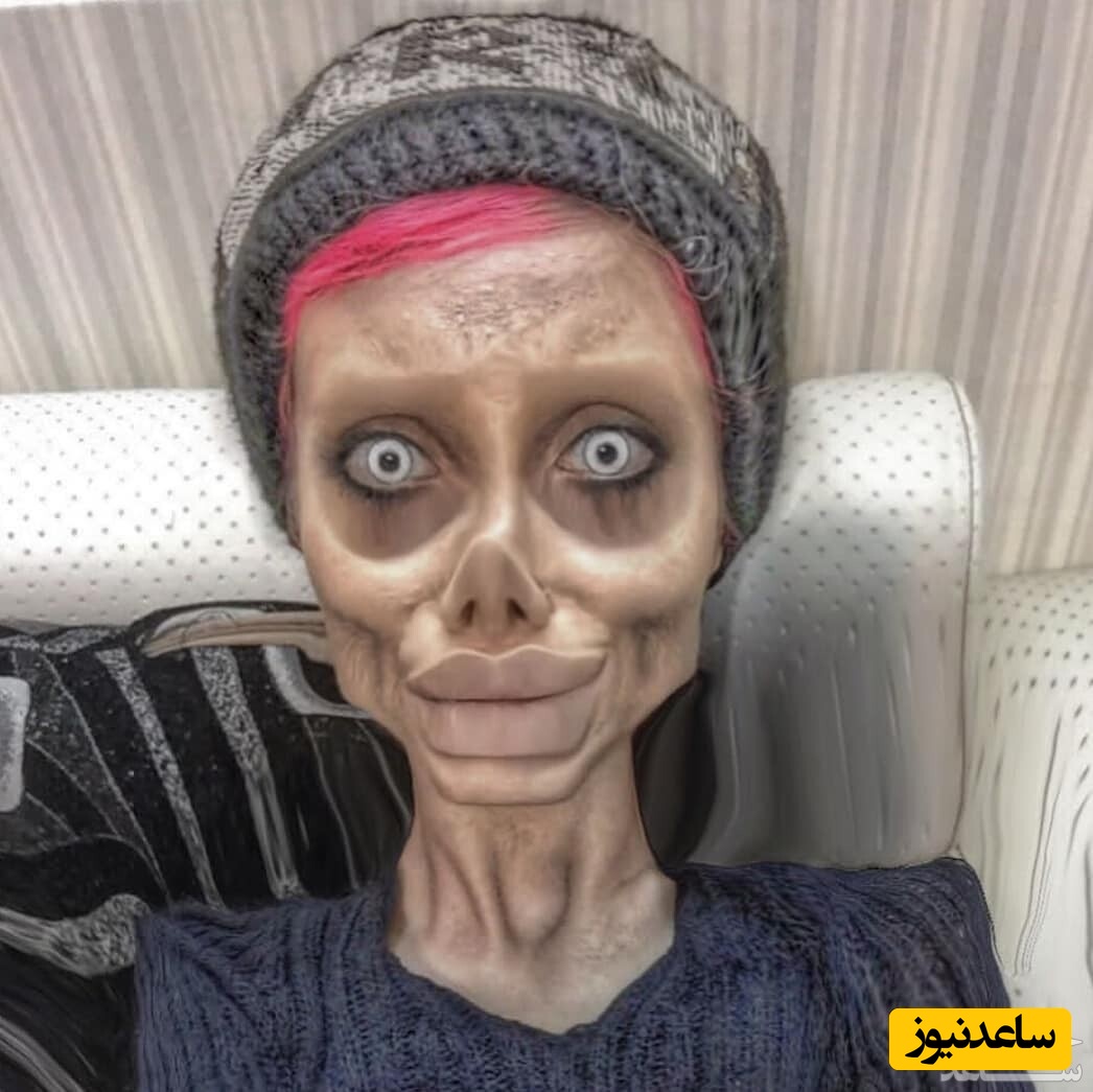 جراحان زیبایی زیرزمینی و اینستاگرامی و نیازِ فیکِ زیبا شدن!